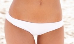 Intim gyantázás workshop kozmetikusoknak